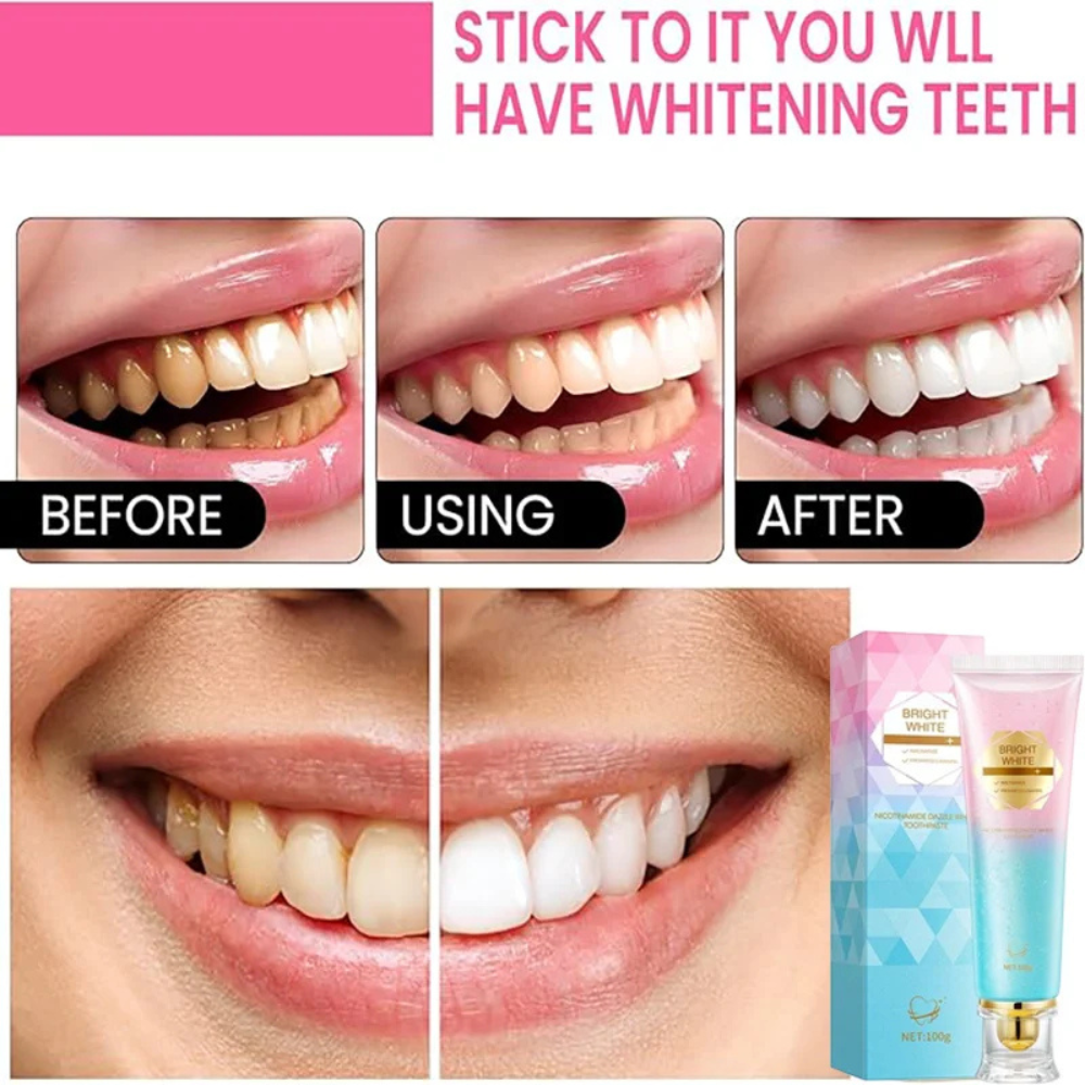 Niacinamide Teeth Whitening Cream